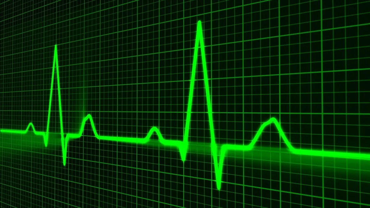 Atrial Fibrillation Patients Risk More Bleeding with Diltiazem and Anticoagulants