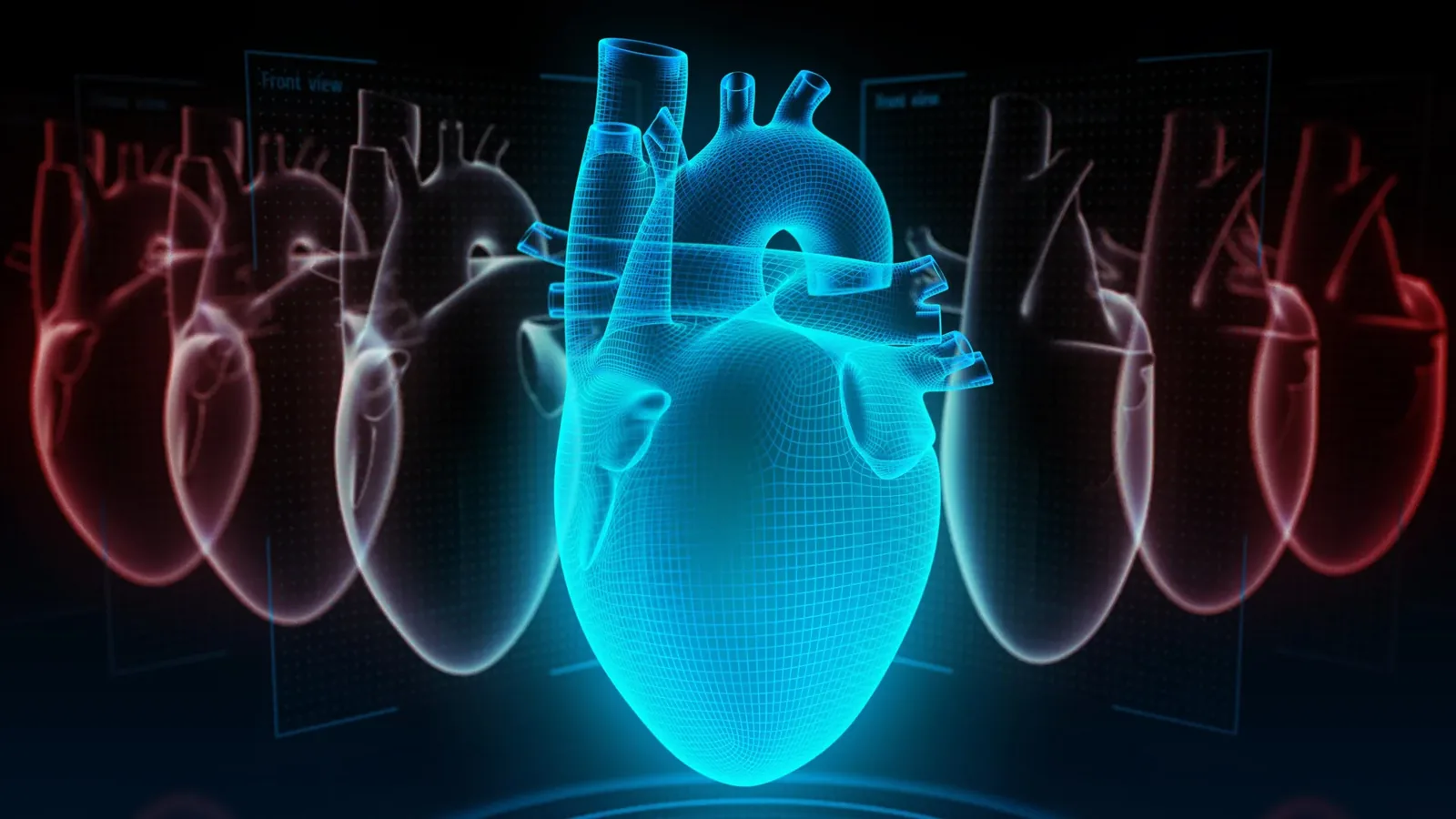 Key to Heart Health: Food Quality in Low-Carb and Low-Fat Diets